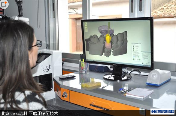 Concept Laser金属3D打印技术显著降低义齿生产成本